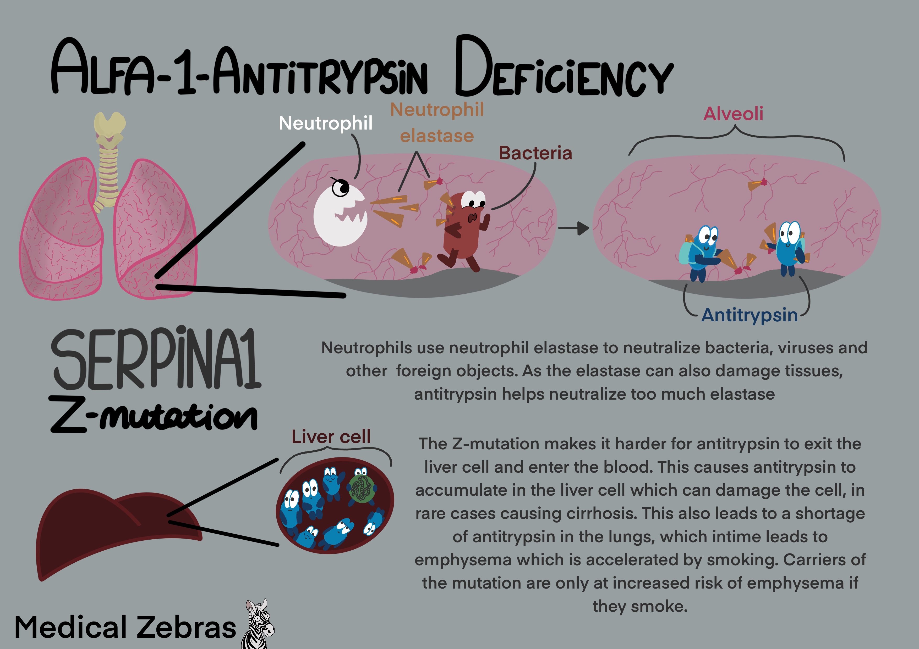 Alpha-1 antitrypsin deficiency made easy / explained