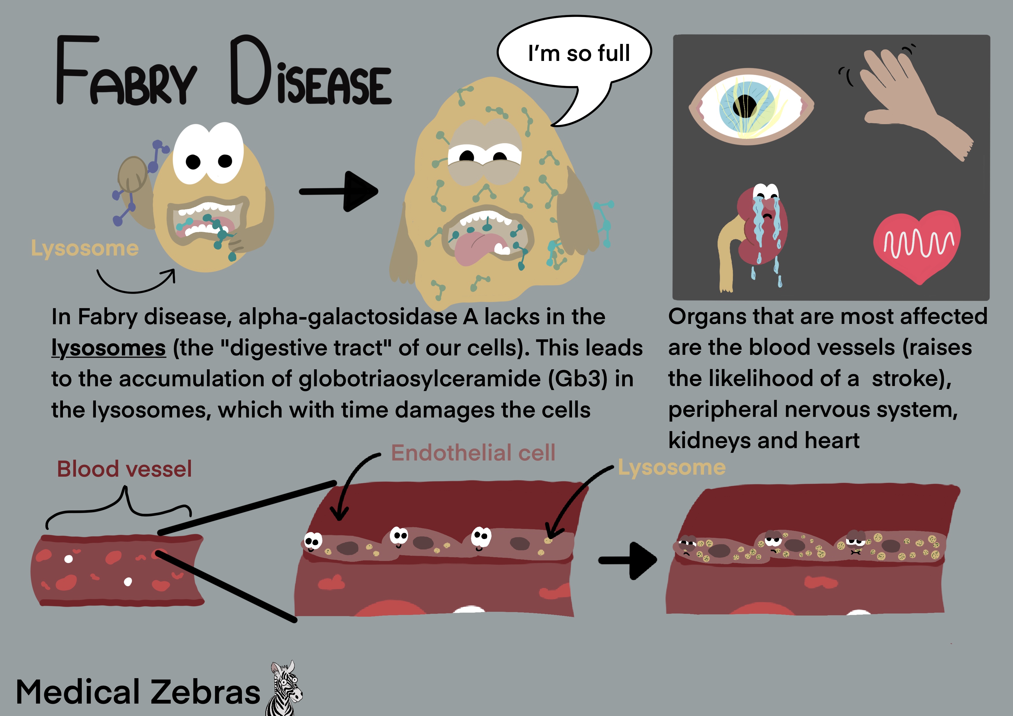 Fabry disease made easy / explained