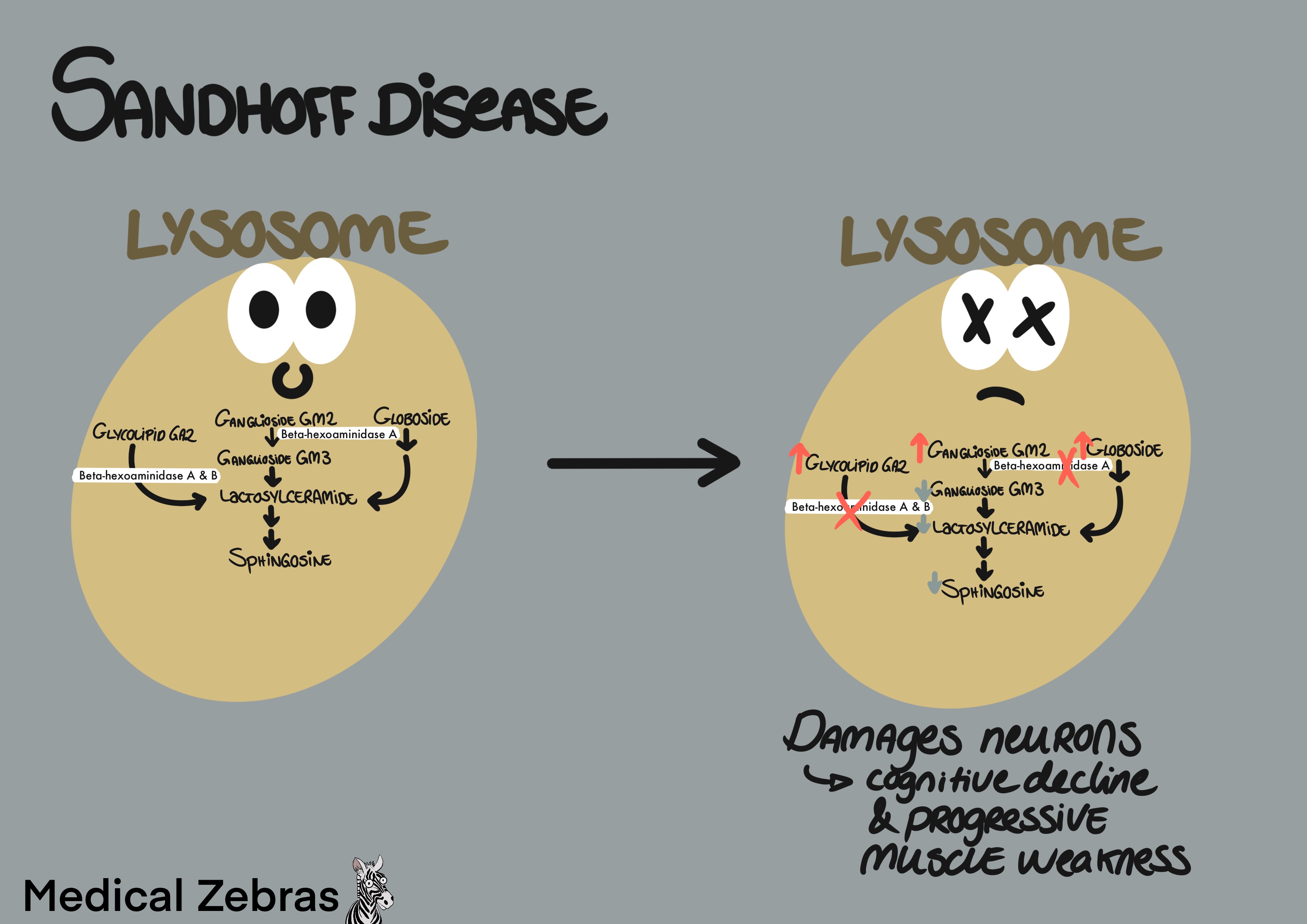 Sandhoff disease explained