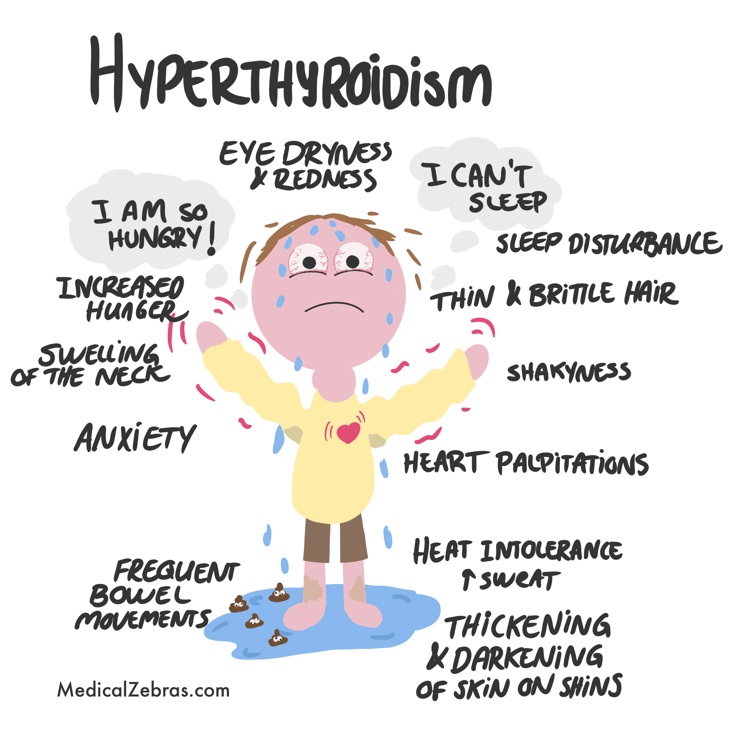 Anaplastic thyroid carcinoma histology pathology explained